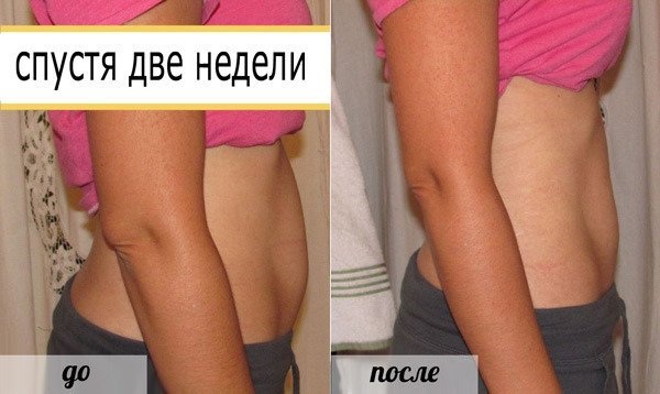Облога за мршављење за стомак и бокове, ноге, руке. Како направити код куће, ефикасни рецепти, фотографије и прегледи
