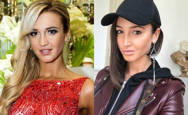 Olga Buzova - ảnh trước và sau khi phẫu thuật thẩm mỹ mũi, môi, gò má. Tôi đã giảm cân như thế nào, tôi đã phẫu thuật thẩm mỹ gì