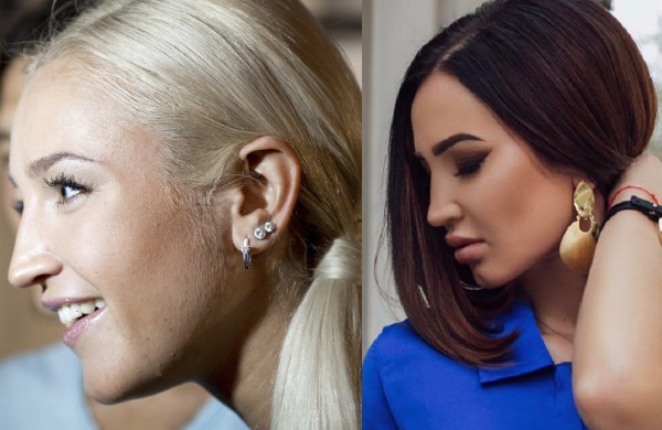 Olga Buzova - ảnh trước và sau khi phẫu thuật thẩm mỹ mũi, môi, gò má. Tôi đã giảm cân như thế nào, tôi đã phẫu thuật thẩm mỹ gì