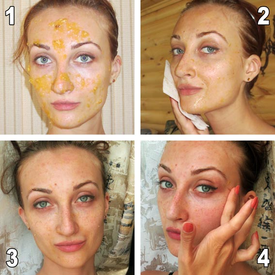 Lợi ích và tác hại của việc lột mặt: hóa chất, axit trái cây, glycolic, phần cứng, retinol, Jessner, axit succinic, với canxi