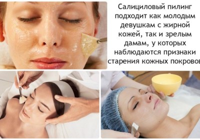 Lợi ích và tác hại của việc lột mặt: hóa chất, axit trái cây, glycolic, phần cứng, retinol, Jessner, axit succinic, với canxi