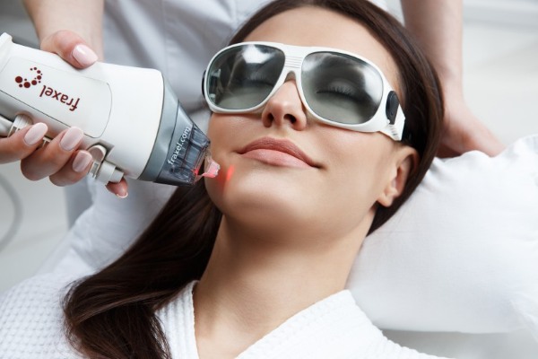 Lợi ích và tác hại của việc lột mặt: hóa chất, axit trái cây, glycolic, phần cứng, retinol, Jessner, axit succinic, với canxi