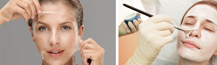 Lợi ích và tác hại của việc lột mặt: hóa chất, axit trái cây, glycolic, phần cứng, retinol, Jessner, axit succinic, với canxi