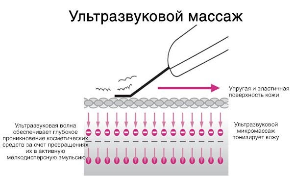 Top 10 máy siêu âm làm sạch da mặt tại nhà chuyên nghiệp. Bài đánh giá, ảnh và kết quả