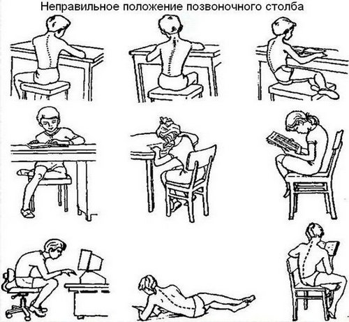 Bài tập tư thế lưng trong phòng gym, tại nhà cho các bạn nữ, các bạn nữ, tuổi teen. Cách thực hiện, hình ảnh và video