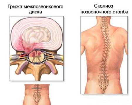 Bài tập tư thế lưng trong phòng gym, tại nhà cho các bạn nữ, các bạn nữ, tuổi teen. Cách thực hiện, hình ảnh và video