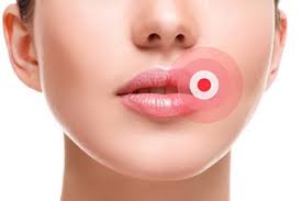 Chất làm đầy dựa trên axit hyaluronic. Tên, loại, hành động, hiệu ứng ứng dụng, giá cả và đánh giá