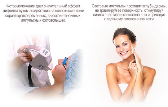 Trẻ hóa khuôn mặt - nó là gì, ưu và nhược điểm, trước và sau khi chụp ảnh, chỉ định và chống chỉ định