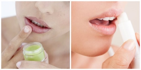 Cách làm to môi bằng axit hyaluronic, botox, silicone, làm đầy môi, tạo hình môi. Kết quả: ảnh trước và sau, giá cả, đánh giá