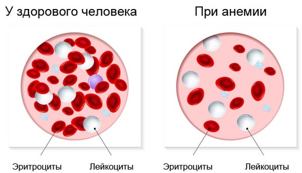 Како ојачати нокте како се не би љуштили и ломили код куће Разлог за крхкост, како лечити