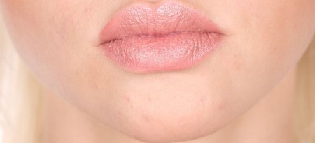 Sản phẩm chăm sóc da mặt: mỹ phẩm, hiệu thuốc chuyên nghiệp, rẻ tiền, công thức dân gian