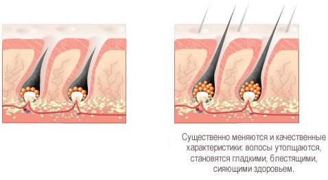 Маска за раст косе са црвеним бибером. Рецепт како га користити код куће, са циметом, чичковим уљем