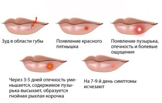 Thuốc mỡ trị sẹo và vết sẹo trên mặt sau khi bị mụn trứng cá, thủy đậu, phẫu thuật cắt mí mắt, phẫu thuật.Phương tiện hiệu quả và rẻ tiền