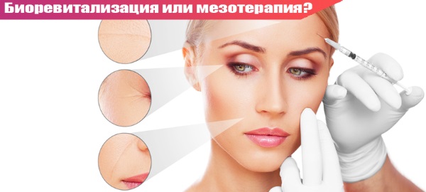 Mesotherapy và biorevitalization: sự khác biệt, lợi ích và tác hại sau khi lột da, chỉ định và chống chỉ định