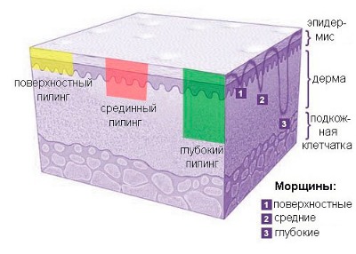 Mesotherapy và biorevitalization: sự khác biệt, lợi ích và tác hại sau khi lột da, chỉ định và chống chỉ định