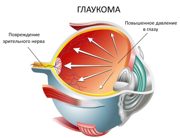 Никотинска киселина у таблетама за косу, маске за раст. Упутства за употребу, прегледи лекара