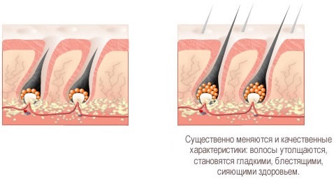 Никотинска киселина у таблетама за косу, маске за раст. Упутства за употребу, прегледи лекара