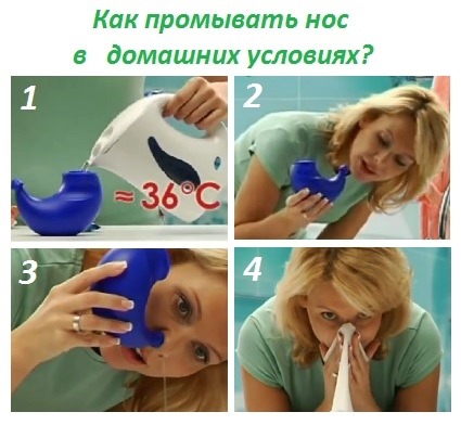 Phẫu thuật vẹo vách ngăn mũi: giai đoạn hậu phẫu, chăm sóc mũi sau chỉnh sửa, phục hồi chức năng. Một bức ảnh