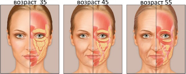 Inchaço sob os olhos pela manhã. Causas e tratamento em mulheres e homens, hematomas matinais, vermelhidão, bolsas nas maçãs do rosto