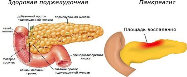 Интравенска терапија озоном. Прегледи лекара, индикације и контраиндикације, користи и штете, ток лечења, да ли је могуће спровести током трудноће
