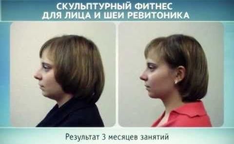 Ревитоника. Детаљан видео курс основних вежби Наталије Осминине, Анастасије Дубинске. Прегледи лекара