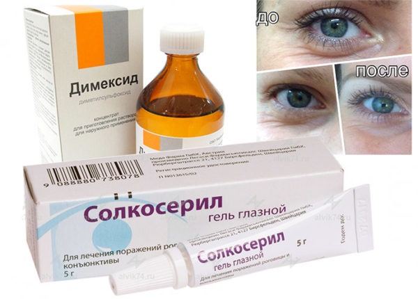 Солцосерил за лице од бора: прегледи козметолога, шта је боље гел или маст, како користити код куће
