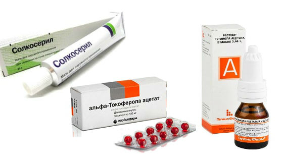مرهم Solcoseryl. تعليمات للاستخدام في مستحضرات التجميل والسعر والمراجعات