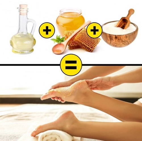 Biện pháp khắc phục cho gót chân nứt nẻ: dân gian với glycerin, amoniac, giấm, trứng, peroxide, lô hội, vitamin E, calendula