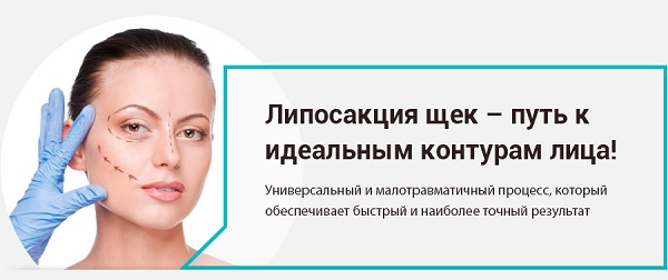 Термаж лица - шта је овај поступак, како се ради, у чему је разлика код РФ-лифтинга. Фотографије, резултати, цена, прегледи