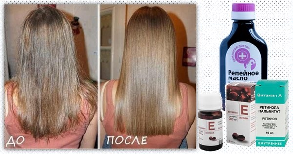 Viên nang vitamin E cho tóc. Cách sử dụng làm mặt nạ, dầu gội, xả tóc, massage đầu tại nhà