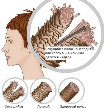 Vitamin chống rụng tóc ở phụ nữ. Đánh giá tốt nhất, danh sách các sản phẩm rẻ tiền, sau sinh, với kẽm và sắt