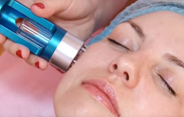 Mesotherapy phần cứng không tiêm trên khuôn mặt. Thủ tục này là gì, lợi ích, hiệu quả, giá cả