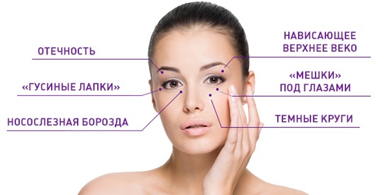Blepharoplasty. Hình ảnh sau phẫu thuật theo ngày. Các biến chứng, phục hồi sau vòng tròn, dưới, trên. Phục hồi chức năng, hậu quả