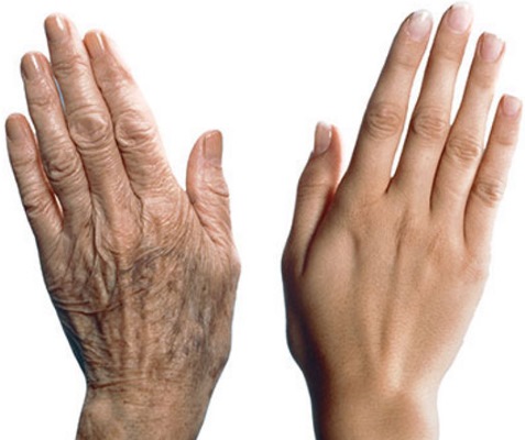 Dermapen: บทวิจารณ์ของขั้นตอนด้วยเครื่องมือฟิลเลอร์สำหรับการทำ Mesotherapy แบบเศษส่วน ซื้อที่ไหนวิธีใช้