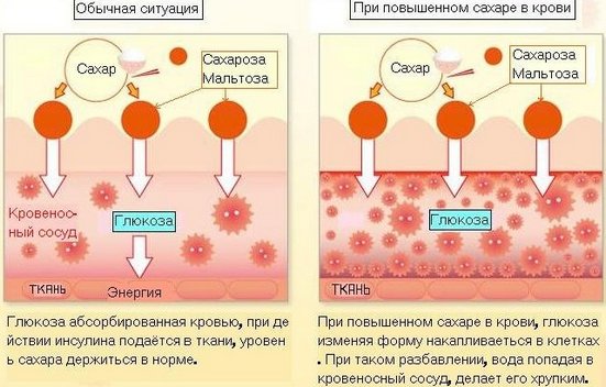 Диодно ласерско уклањање длака. Апарати за поступак, припрему, како ласер ради. Рецензије, пре и после фотографија