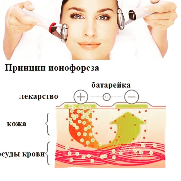 Ionoforesi: che cos'è in cosmetologia, con iperidrosi. Il prezzo della procedura. Dispositivi per il viso a casa, farmaci