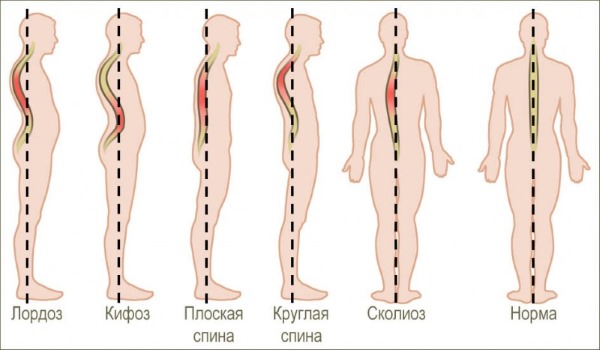 Cách học kéo xà ngang từ đầu trong một tuần cho một cô gái và một chàng trai. Chương trình tại nhà cho người mới bắt đầu