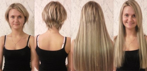 Viên nang mở rộng tóc. Các loại, ưu nhược điểm, hậu quả, bao nhiêu là đủ, giá bao nhiêu, cách loại bỏ. Cái nào tốt hơn: viên nang hoặc băng