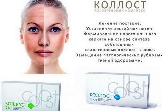 Цоллост - шта је то, прегледи козметолога. Упутства за употребу лека за ожиљке, стрије, цена