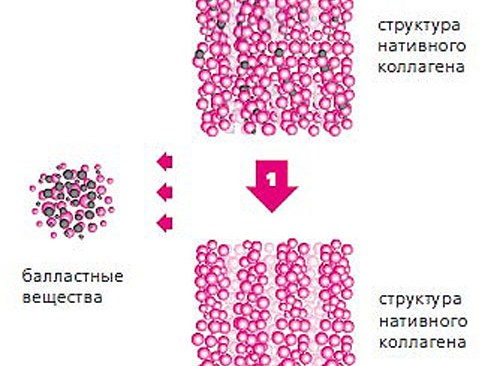 Цоллост - шта је то, прегледи козметолога. Упутства за употребу лека за ожиљке, стрије, цена