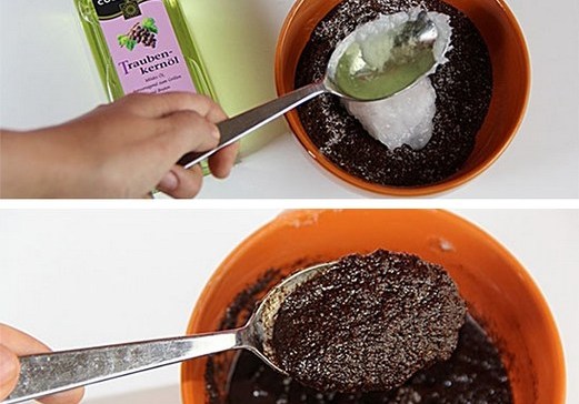 A pele dos cotovelos descama e racha, coça. Motivos, fotos, remédios caseiros, receitas populares, cremes, pomadas na farmácia