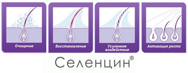 Најбољи лекови за губитак косе код жена током трудноће, лактације, након порођаја, бојења, хемотерапије, хормоналних поремећаја
