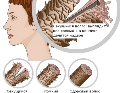 Маске за суву косу против губитка косе, за раст и густину. Рецепти како кувати код куће