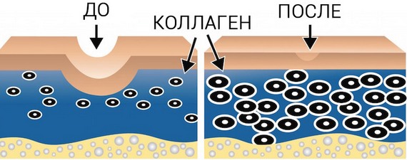 Mặt nạ collagen. Đánh giá các loại mặt nạ được mua tốt nhất, công thức làm mặt nạ tự chế, khuyến nghị sử dụng