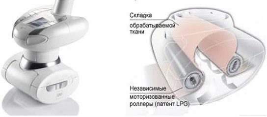 ЛПГ масажа за лице и тело. Рецензије, пре и после фотографија, ефикасност
