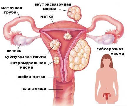 Зашто стомак расте код жена након 40, 50 година и како га уклонити. Узроци и лекови