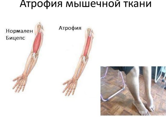 Myostimulation: nó là gì, hiệu quả, chỉ định và chống chỉ định, chi phí, thiết bị để thực hiện thủ thuật tại nhà