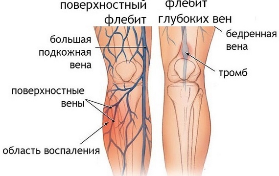 Myostimulation: nó là gì, hiệu quả, chỉ định và chống chỉ định, chi phí, thiết bị để thực hiện thủ thuật tại nhà