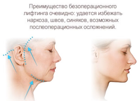 جراحة تجميل الوجه. صور قبل وبعد جراحة نحت الجسم بحمض الهيالورونيك. الأسعار والاستعراضات