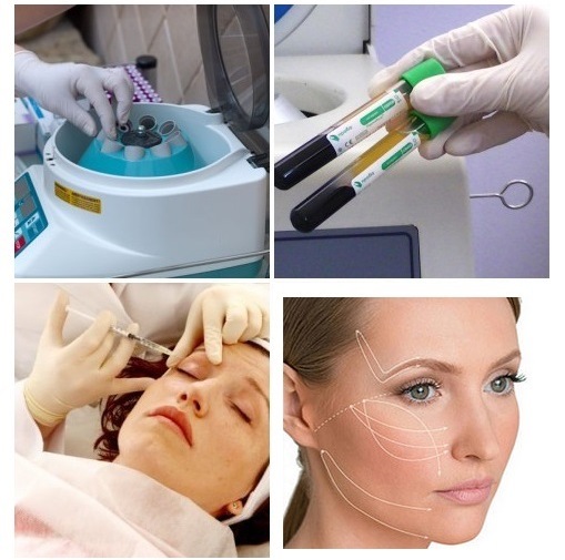 جراحة تجميل الوجه. صور قبل وبعد جراحة نحت الجسم بحمض الهيالورونيك. الأسعار والاستعراضات
